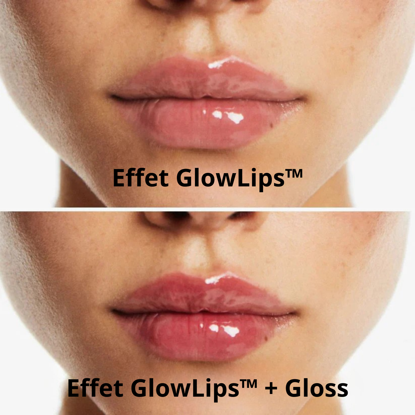 GlowLips™- Agrandisseur de lèvres