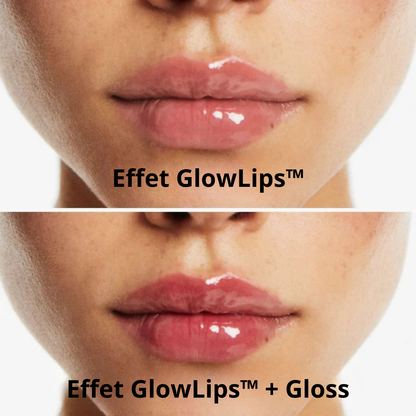 GlowLips™- Agrandisseur de lèvres